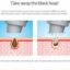 دستگاه میکرودرم آبی ابریژن انزو پروفشنال - Water circulation Deep Cleans Pores - Image 5