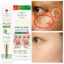کرم ضد لک آیچون بیوتی - Aichun Beauty Highly Whitening Fleck - Image 3