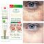 کرم ضد لک آیچون بیوتی - Aichun Beauty Highly Whitening Fleck - Image 4