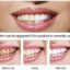 سرم سفیدکننده ی دندان لانبنا - Lanbena teeth whitening essence - Image 6